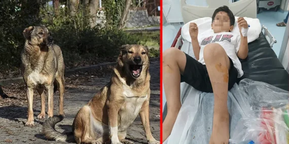 Şanlıurfa’da korkunç olay: Köpekler saldırdı, Abdulkadir yaralandı