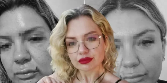 “Bugün büyük gün” diye aradı, dehşet yaşattı: Bıçak sırtında kırıldı