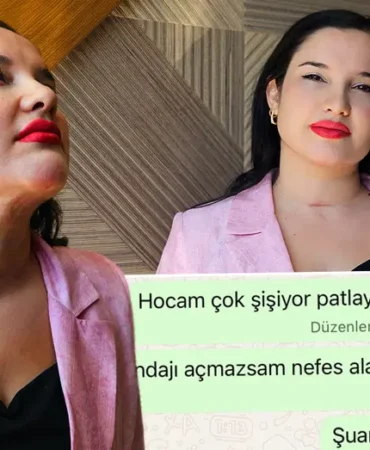 Antalya8217da-estetik-sonrasi-tazminat-davasi-5-milyon-64-bin-lira-featured