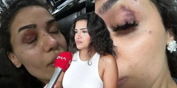 Ebru Hemşire: Eski Sevgilisi Şiddet ve Tehditte Israrcı