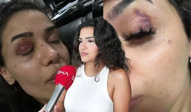 Ebru-Hemsire-Eski-Sevgilisi-Siddet-ve-Tehditte-Israrci-featured